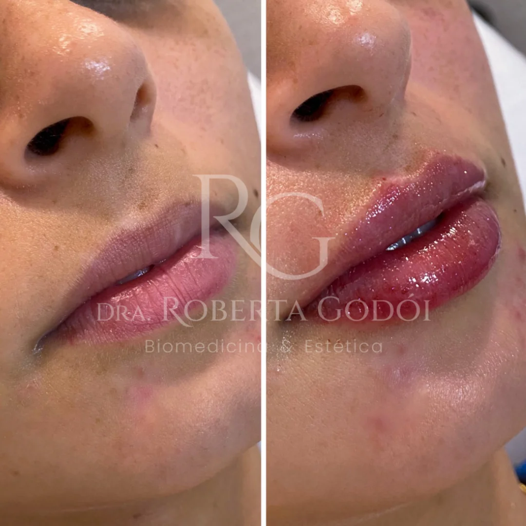 Lábios (2)