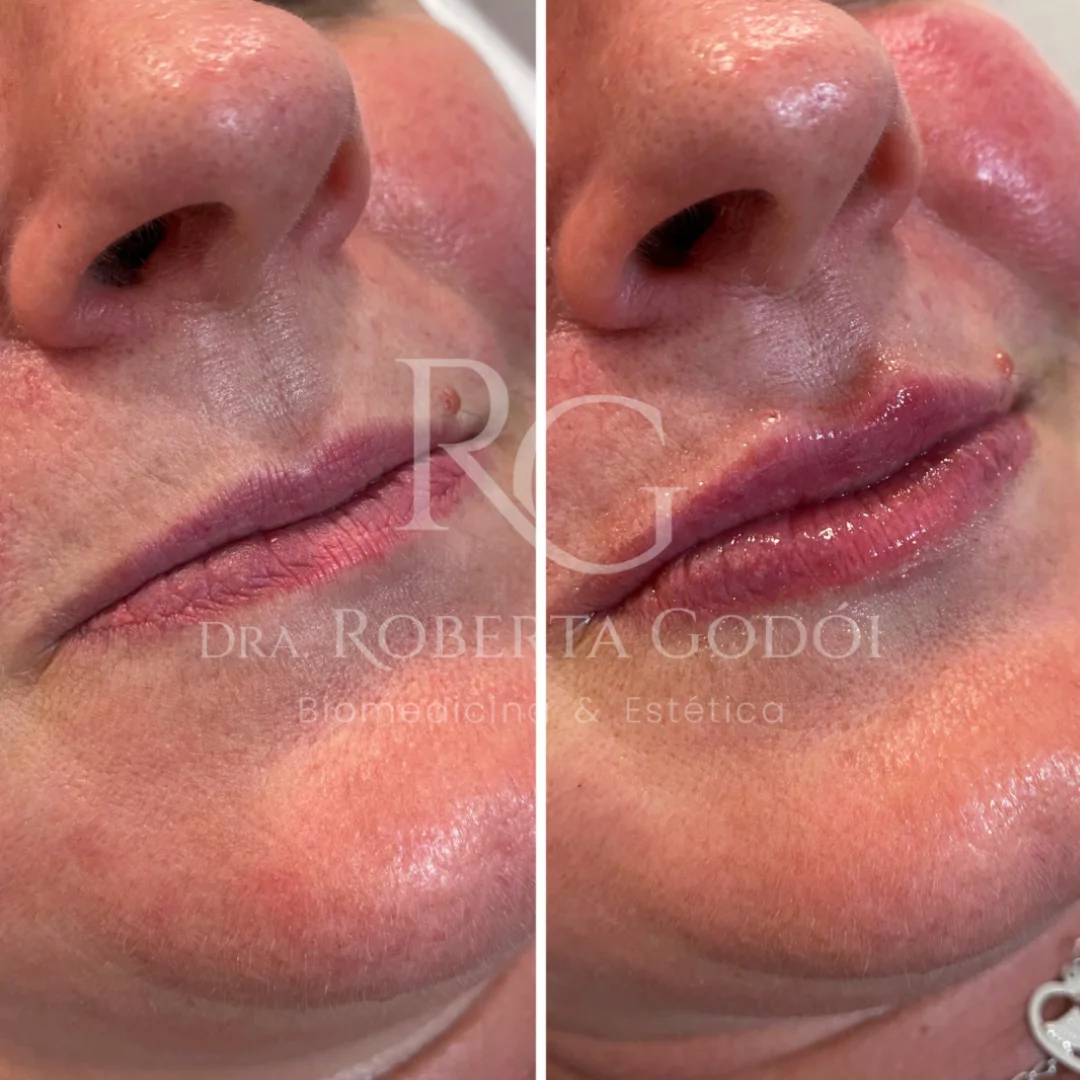 Lábios (3)