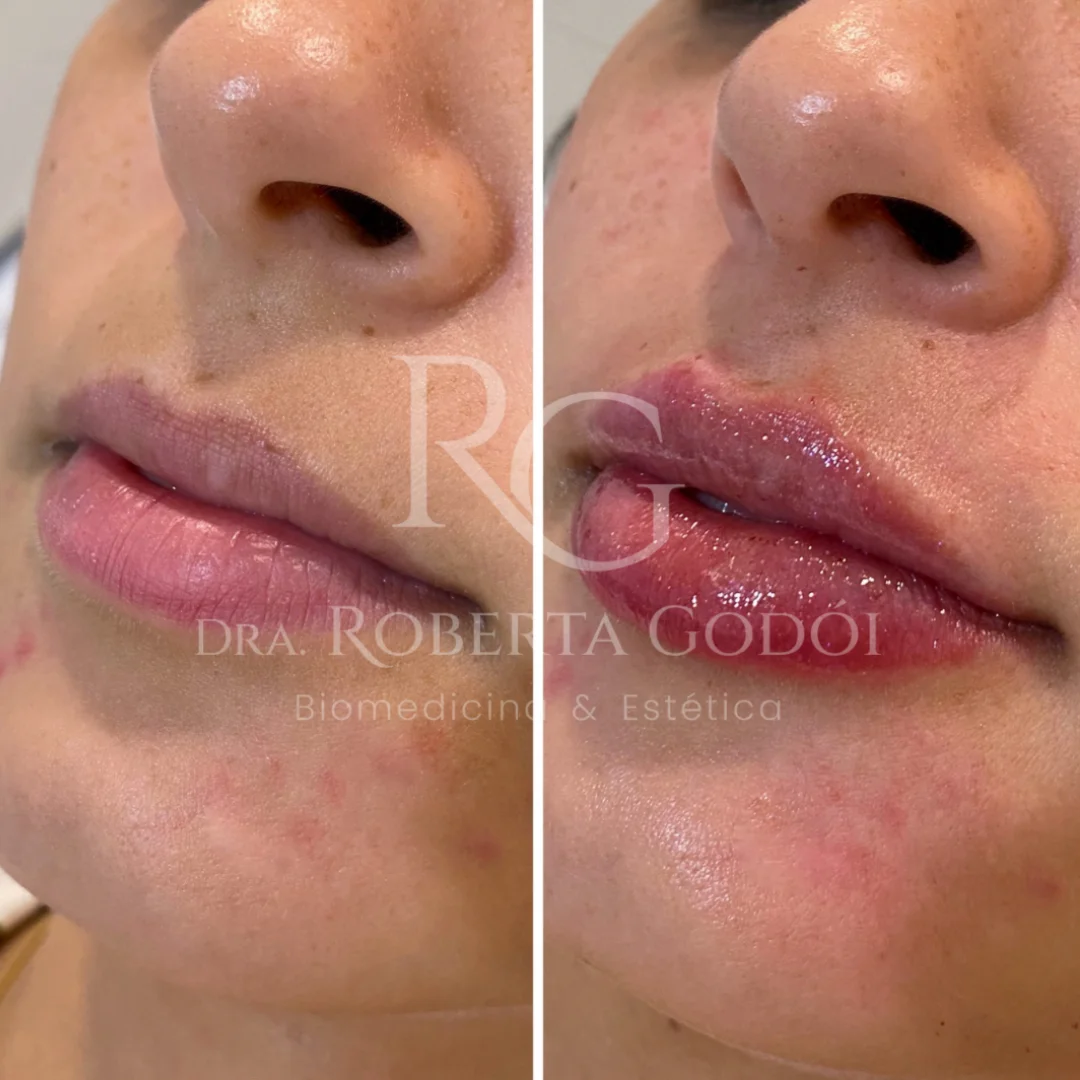 Lábios
